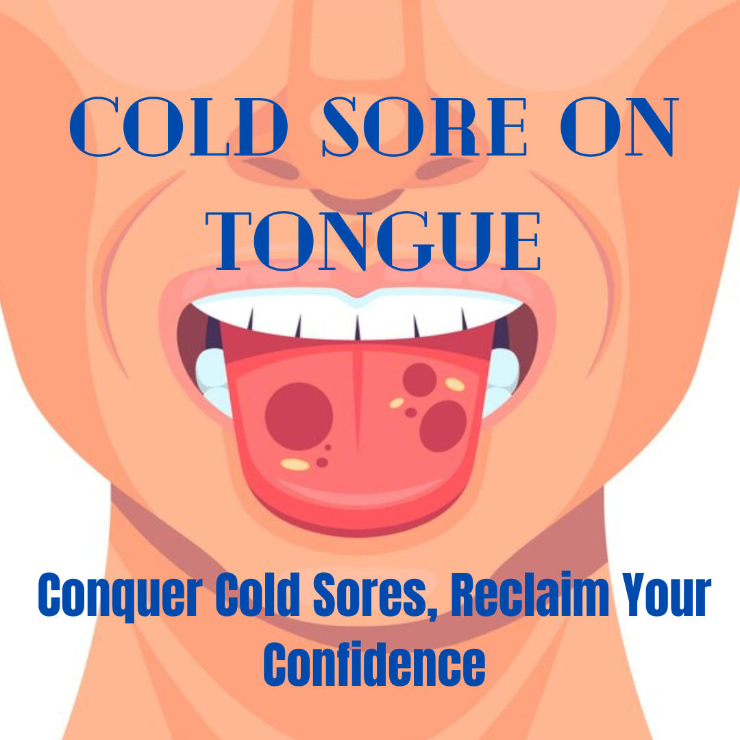 7-cold-sore-on-tongue-mistakes-to-avoid-for-rapid-relief-only-pharmacist